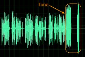 This is the intonation of your voice tone as a graph chart